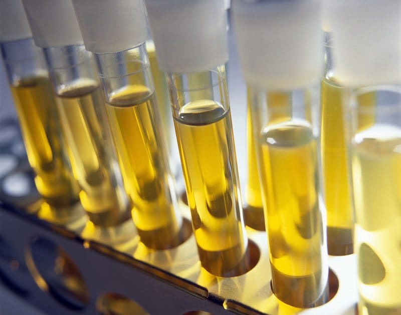 urine for microbial fuel cells